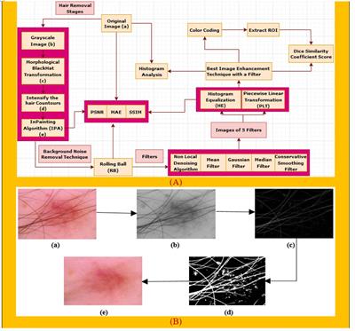 SkinNet-16: A deep learning approach to identify benign and malignant skin lesions